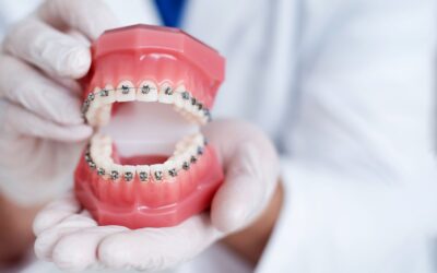 Betting on Braces: 3 Reasons to Choose Traditional Orthodontics